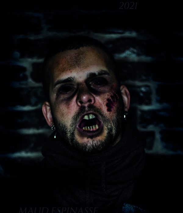 CHRIS-ZOMBIE