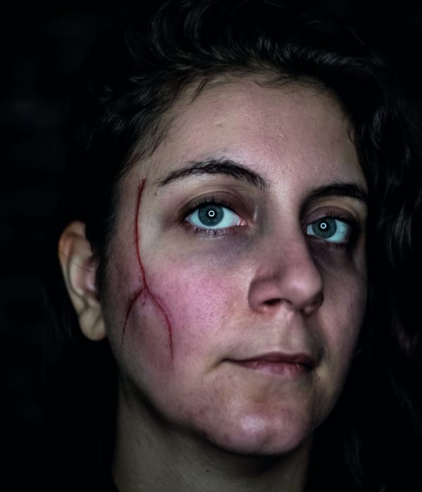 MAUD-SURVIVOR